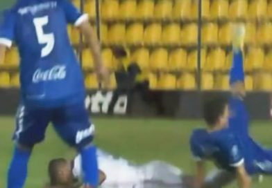 Terrible fractura de futbolista sorprende al mundo entero