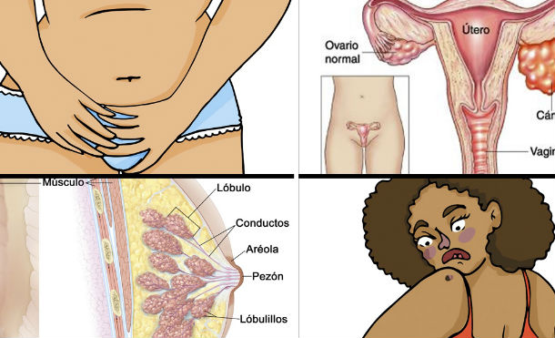 Estas son algunas las señales que las mujeres ignoran, que podrían determinar si sufre algún tipo de cáncer